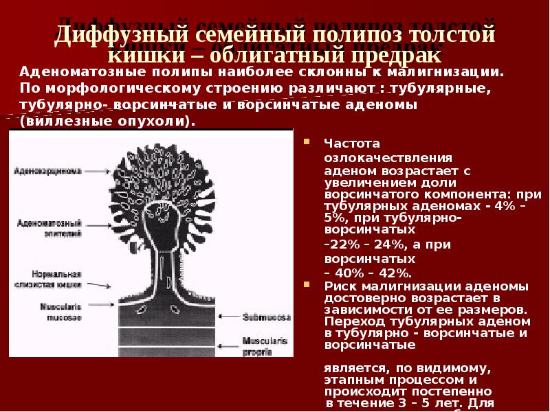 Полипоз кишечника наследственный. Полипоз кишечника макропрепарат. Наследственный полипоз толстой кишки макропрепарат. Аденоматозный полипоз кишечника. Семейный полипоз толстой кишки классификация.