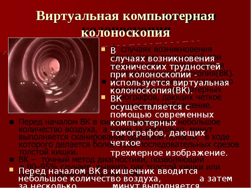 Виртуальная колоноскопия отзывы. Виртуальная колоноскопия. Дивертикулит виртуальная колоноскопия. Компьютерная колоноскопия. Виртуальная колоноскопия позволяет оценить.