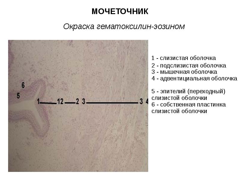 Стенка мочеточника состоит из слизистой мышечной и адвентициальной оболочек