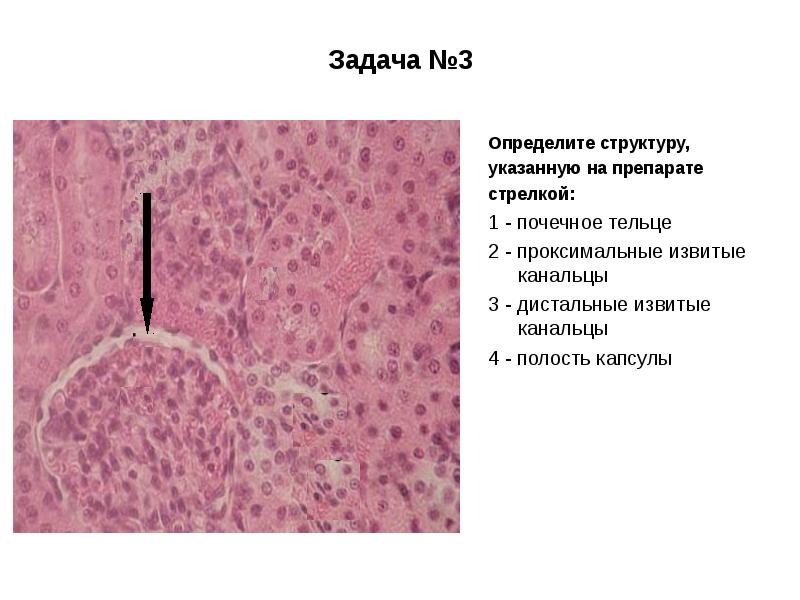 Выделительная система гистология презентация