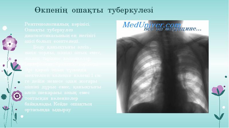 Презентация по фтизиатрии