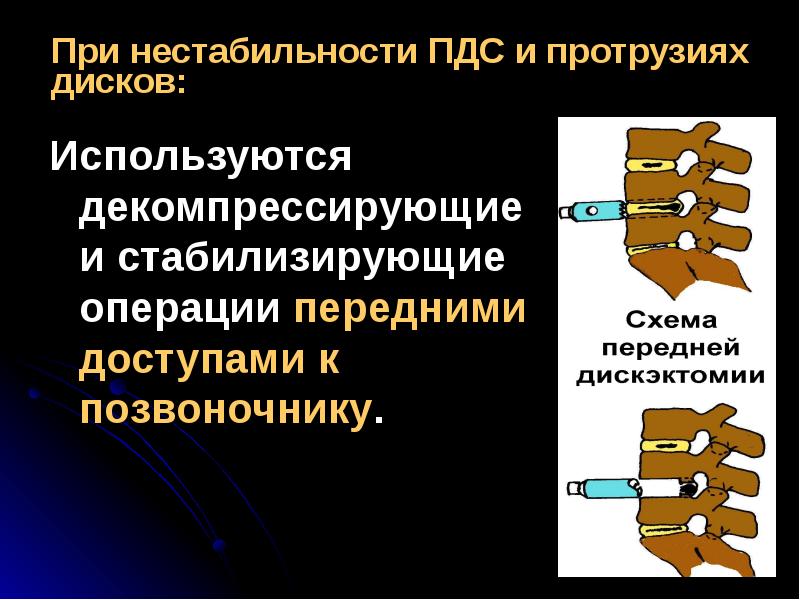 Нестабильность сегментов шейного отдела