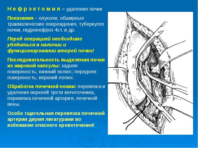 Презентация забрюшинное пространство