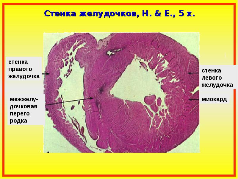 Задняя стенка сердца