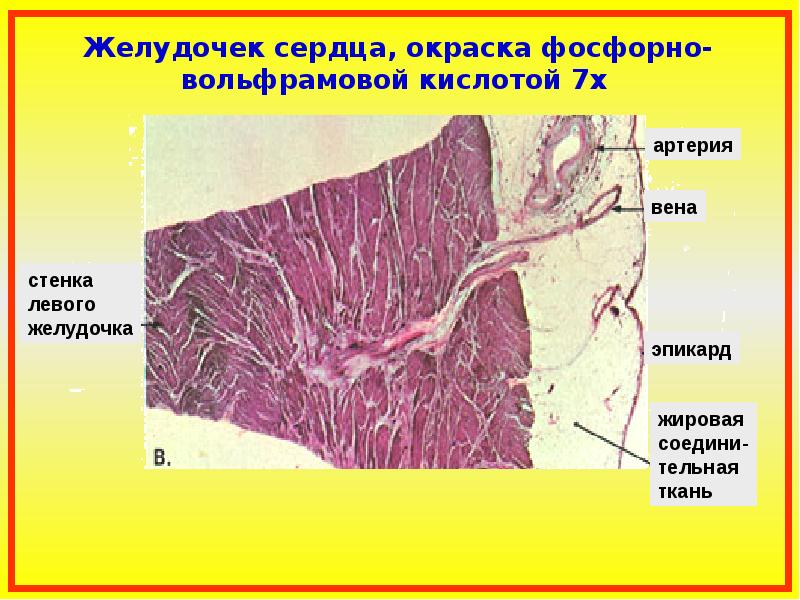 Срез стенки сердца рисунок - 91 фото