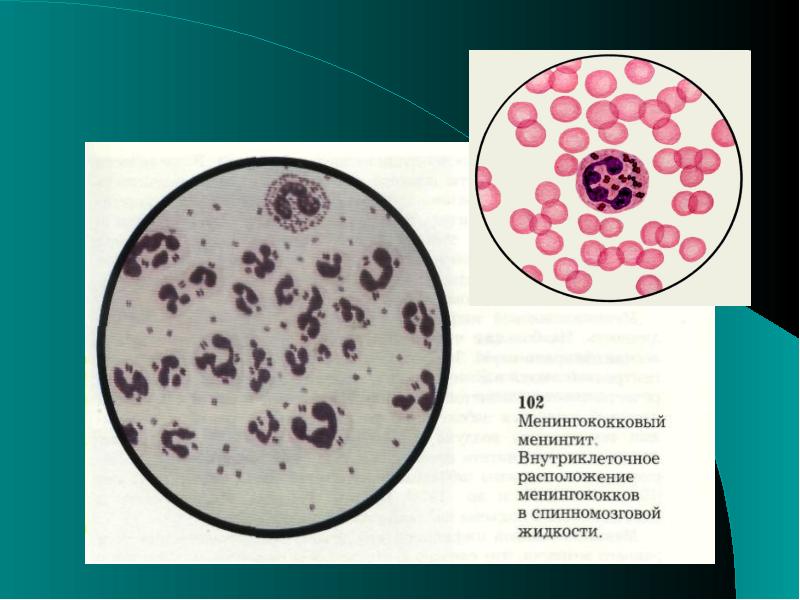 Менингококковый менингит. Менингококцемия микробиология. Менингококковый менингит возбудитель. Менингококковая инфекция презентация. Выявление менингококковой инфекции.