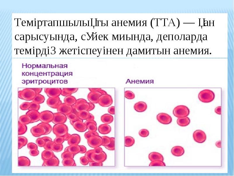 Презентация на тему анемия