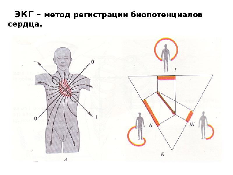 Графическое изображение биотоков сердца называется