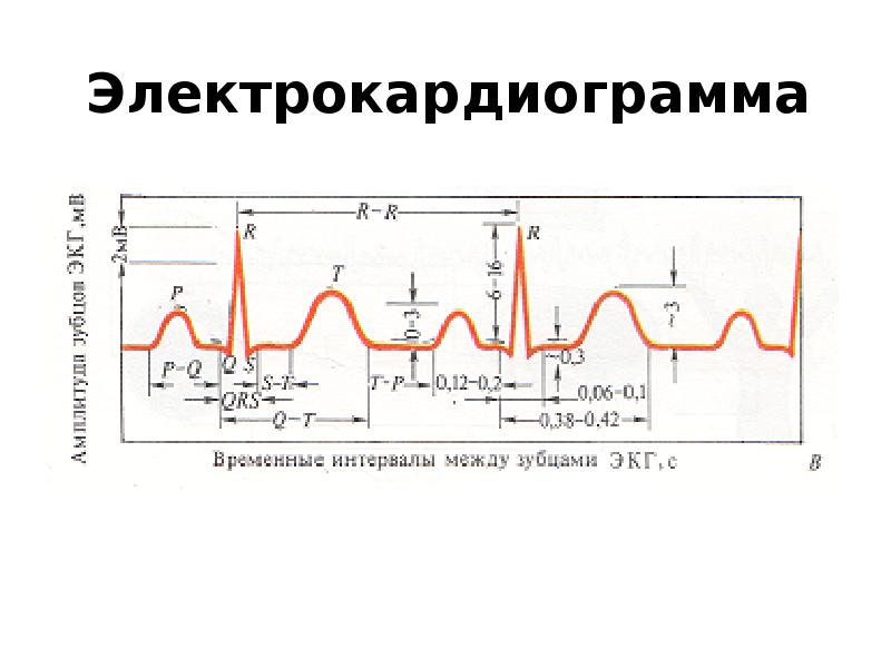 Соотношение ЭКГ И ФКГ. Соотношение ЭКГ И ФКГ физиология. Соотношение тонов ФКГ С зубцами ЭКГ.. Сопоставление ЭКГ И ФКГ.