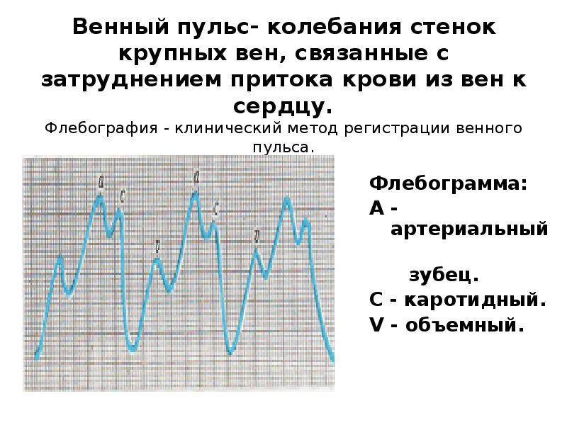 Отрицательный венный пульс