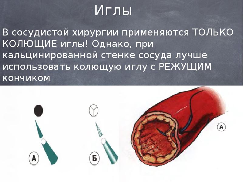 строение сосудистой стенки артерий. слои сосудистой стенки. основа сосуда. повреждение сосудистой стенки. основа сосуда.