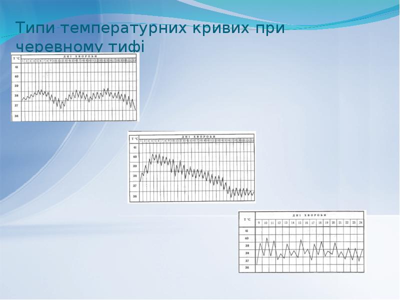 Типи температурних кривих при черевному тифі Типи температурних кривих при черевному тифі