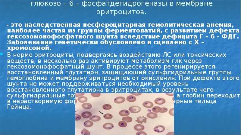 Презентация по гемолитической анемии