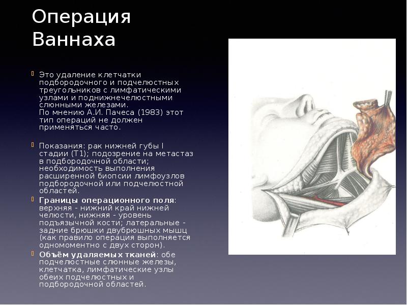 Тест крайля