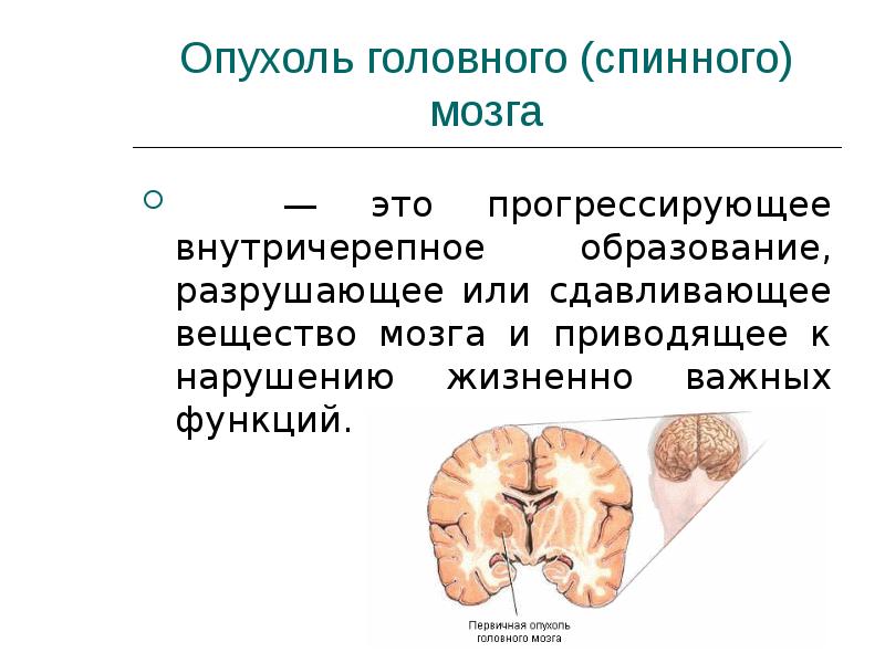 Опухоли головного мозга презентация. Новообразование в головном мозге.