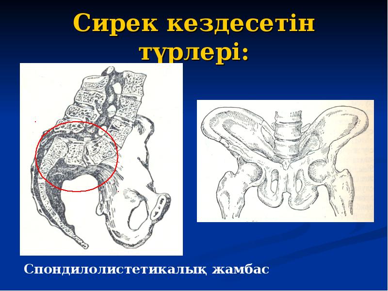 Жамбас. Жамбас