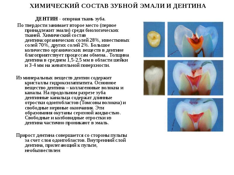 Сидиэр фото жеват текучий дентин шпр 1г 6кан