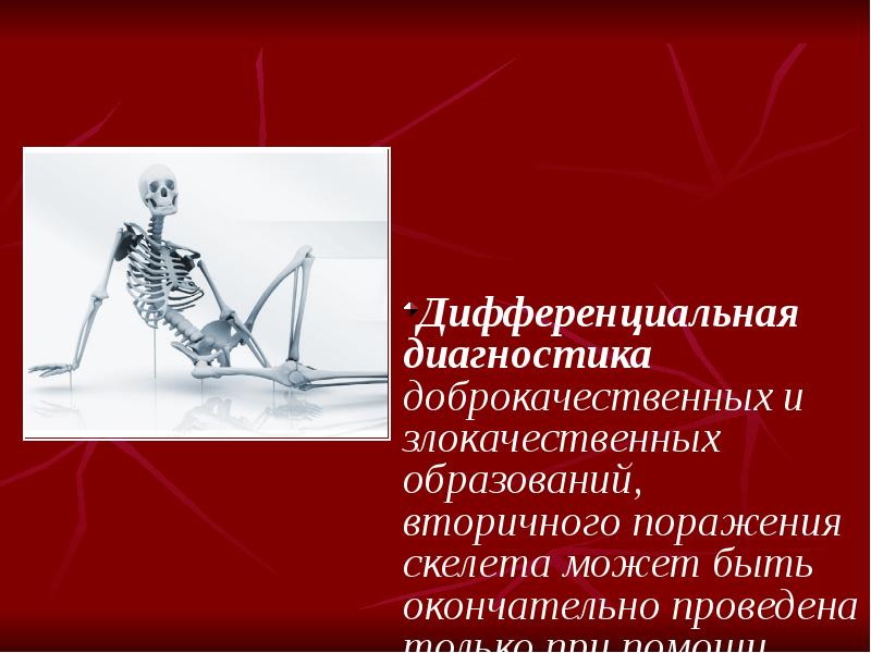 Вторичное поражение костей. Рентгенодиагностика заболеваний костей. Поражение скелета вторичного характера. Инфекционные заболевания костей и суставов презентация. Признаки вторичного поражения скелета.