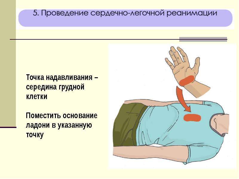 Схема алгоритма оказания первой помощи