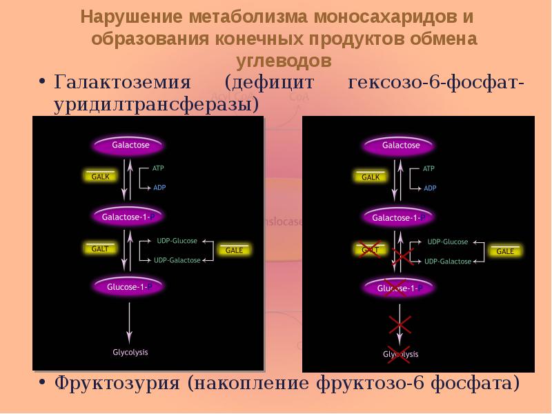 Нарушение метаболизма моносахаридов и образования конечных продуктов обмена углеводов Галактоземия (дефицит