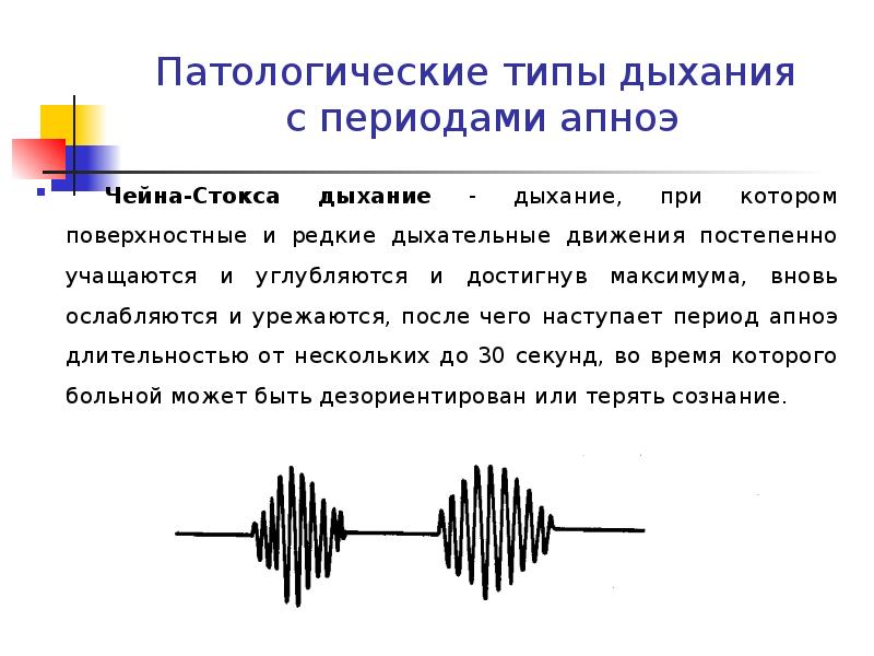 Дыхание чейна стокса что это