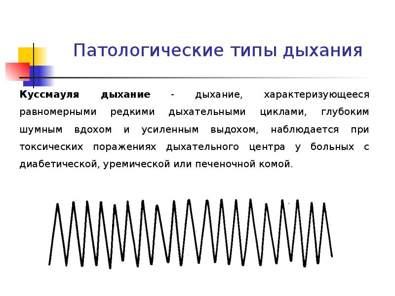 Патологическое дыхание. Дыхание Куссмауля механизм. Дыхание по типу Куссмауля. Патологическое дыхание Куссмауля. Патологические типы дыхания.