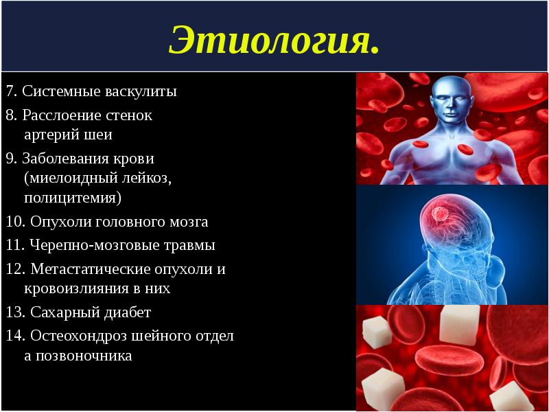 Нарушение мозгового кровообращения презентация