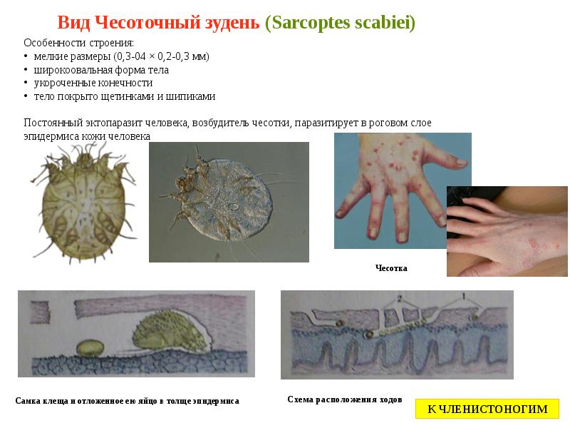 Первые симптомы чесотки фото Медицинская арахноэнтомология