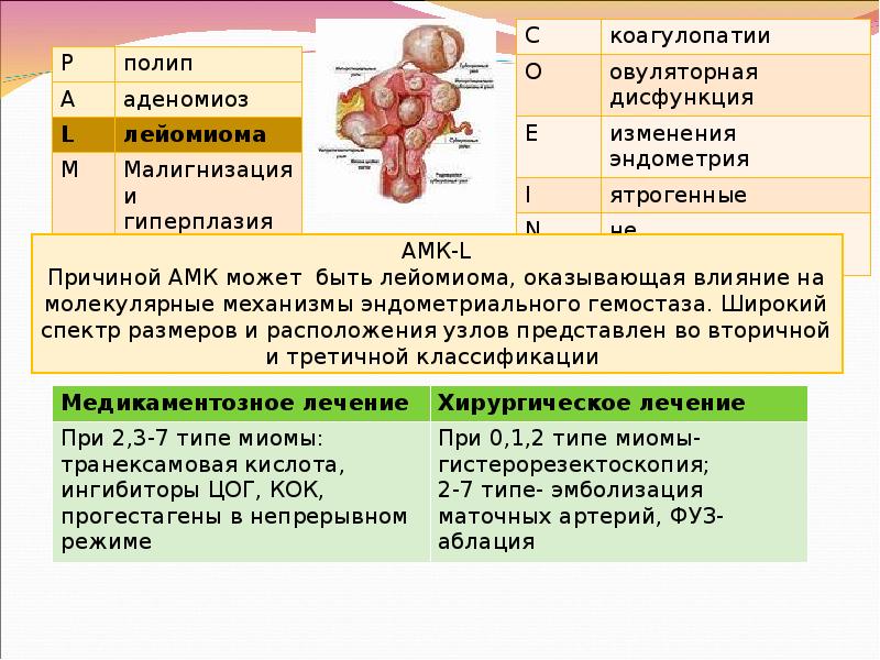 Фиго миома. Аномальные маточные кровотечения классификация. Аномальные маточные кровотечения классификация Palm-COEIN. Классификация маточных кровотечений. Классификация Figo аномальные маточные кровотечения.