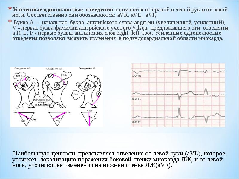 Усиленные отведения экг схема