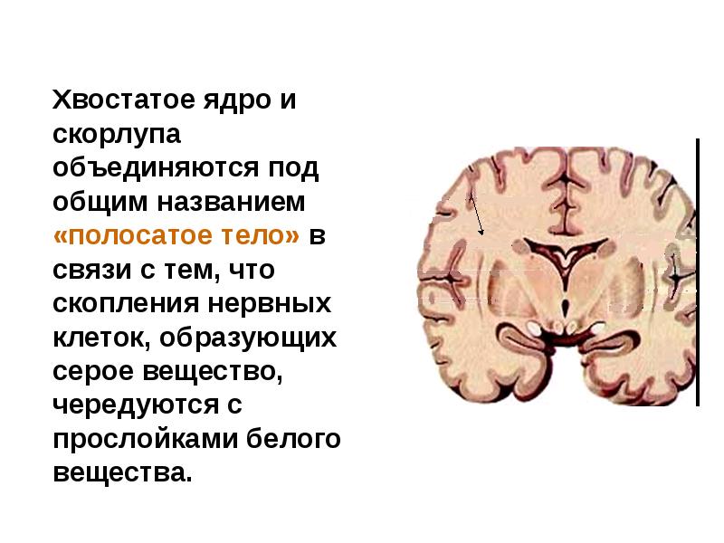 Полосатое тело мозга. Полосатое ядро головного мозга. Функции хвостатого ядра головного мозга. Головка хвостатого ядра головного мозга. Хвостатое ядро мозга функции.