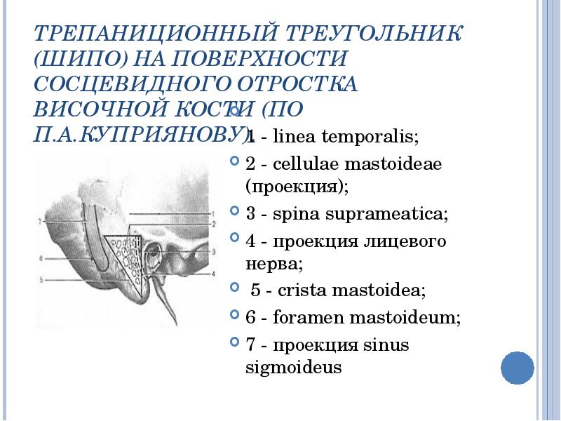 Трепанация треугольника шипо