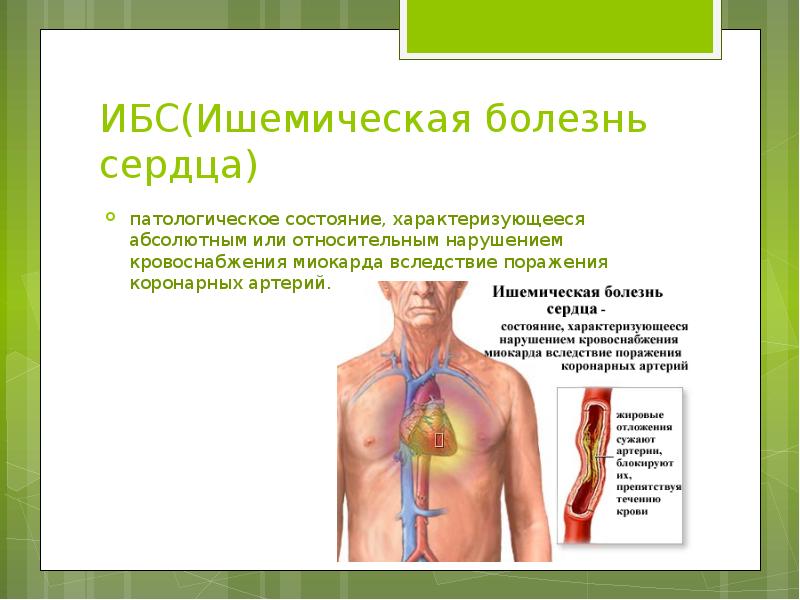 Ишемическая болезнь сердца презентация патанатомия