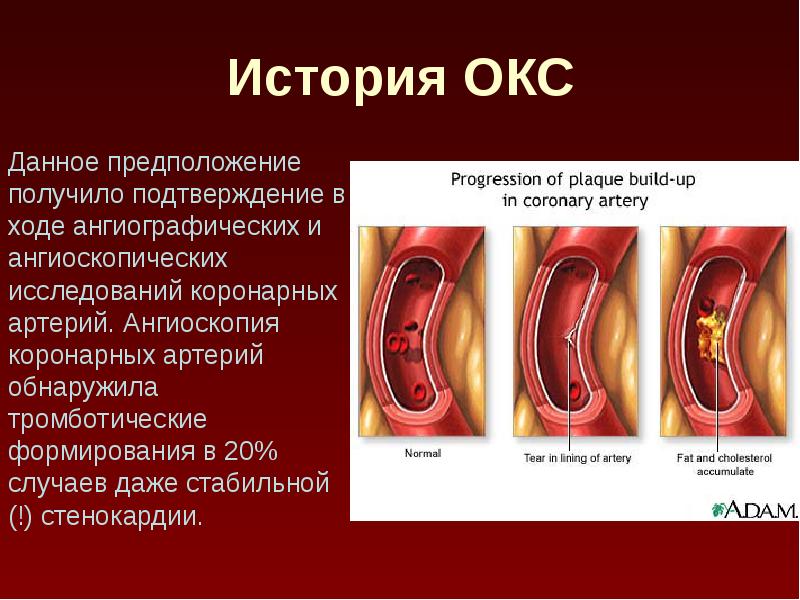 Окс история