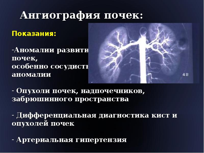 Исследование почек