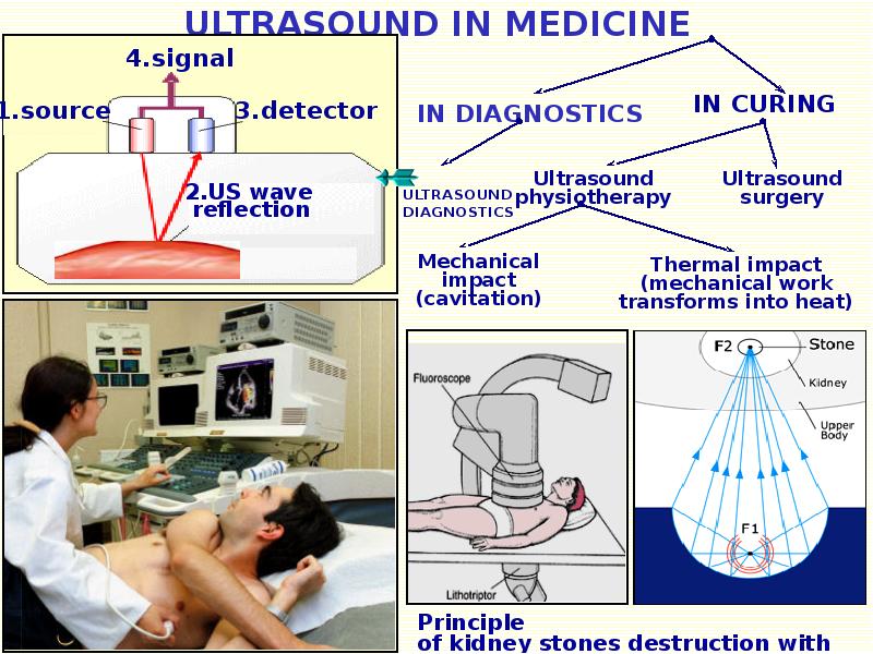 Ультразвук в медицине реферат