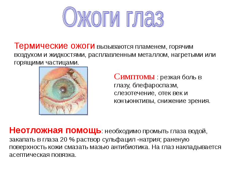 Тепловой и солнечный удар презентация