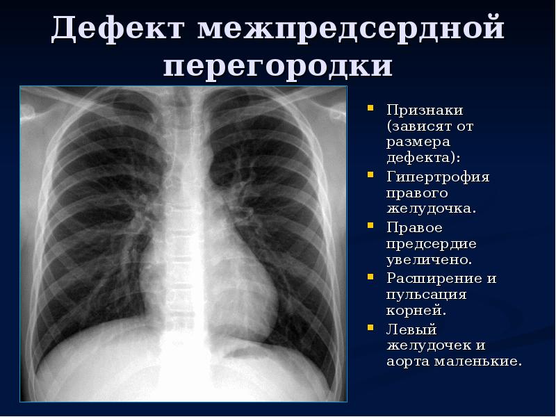 Дмпп у детей презентация