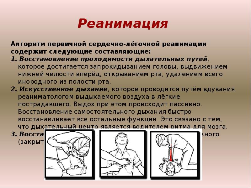 Оказание реанимационной помощи презентация