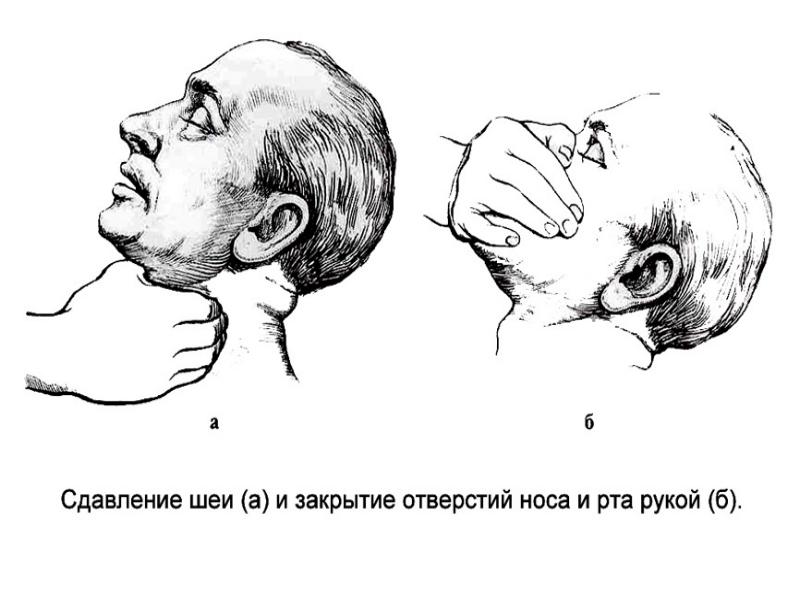 Судебная медицина асфиксия презентация