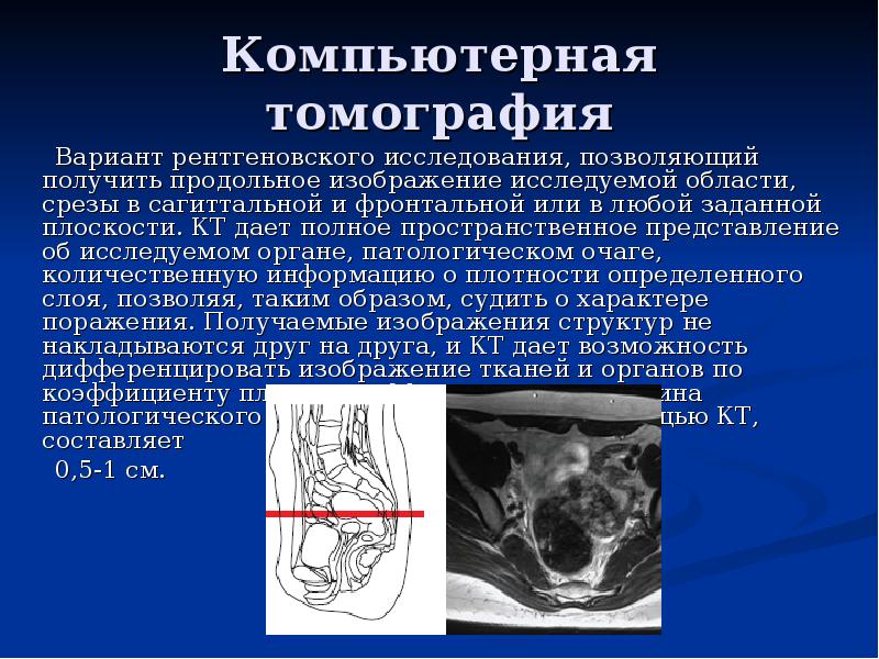 8 рентгенологическое исследование при котором получают изображение исследуемого объекта это