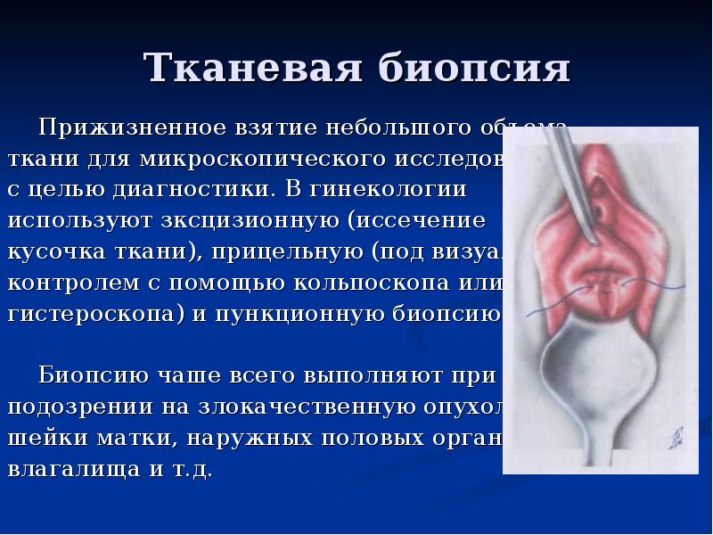 Тканевая биопсия   Прижизненное взятие небольшого объема  ткани для
