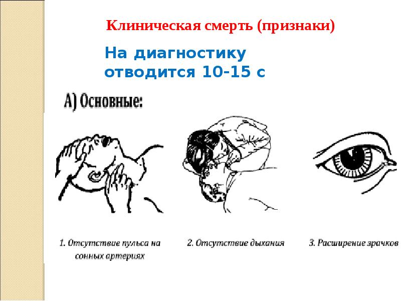 Признаки биологической смерти картинки