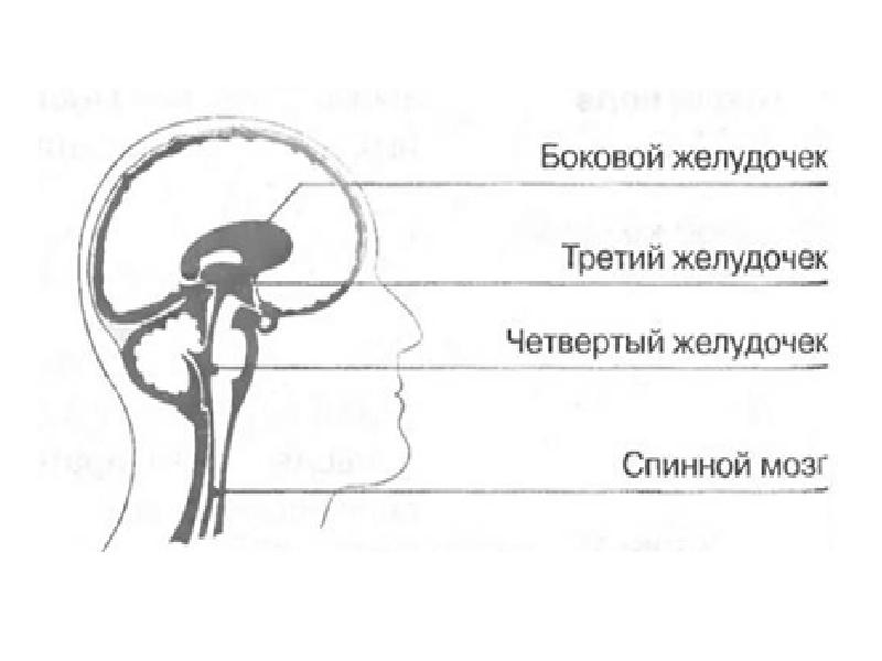 3 желудочек