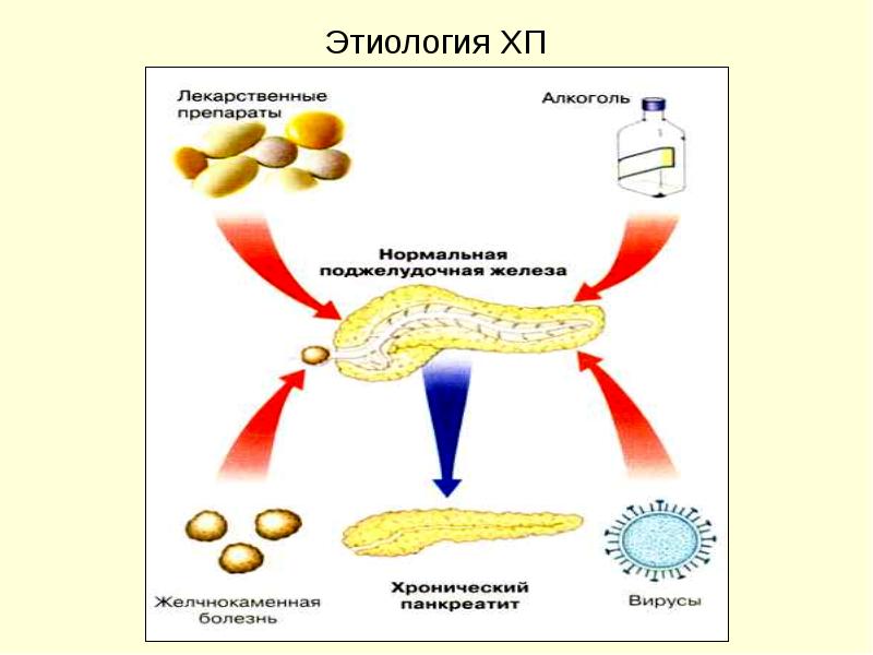 Хронический панкреатит патофизиология презентация