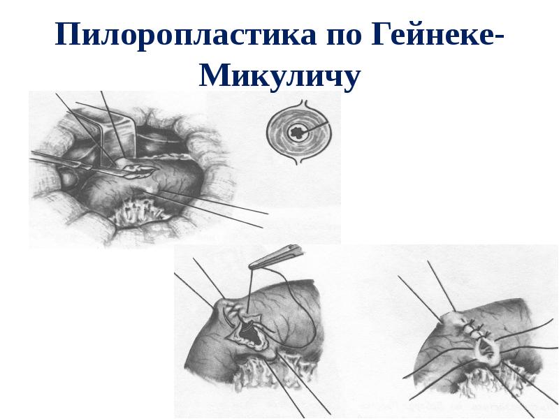 Желудок клапаны анатомия