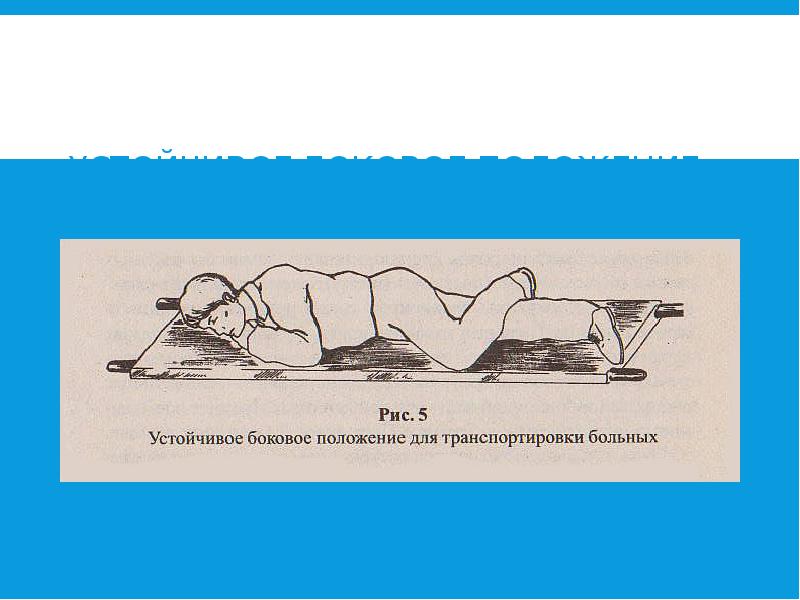 УСТОЙЧИВОЕ БОКОВОЕ ПОЛОЖЕНИЕ ДЛЯ ТРАНСПОРТИРОВКИ БОЛЬНЫХ