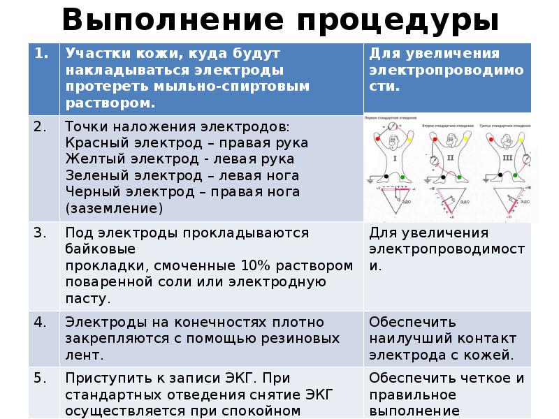 Снятие экг алгоритм