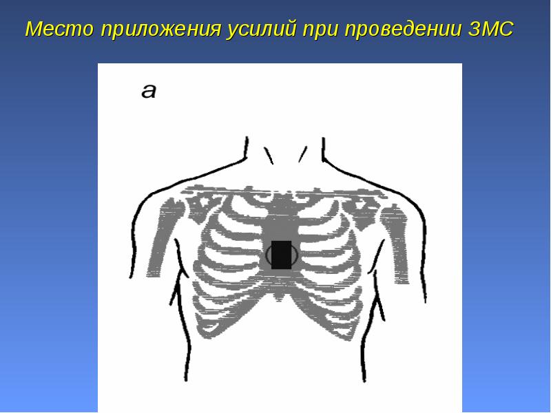 Место приложения усилий