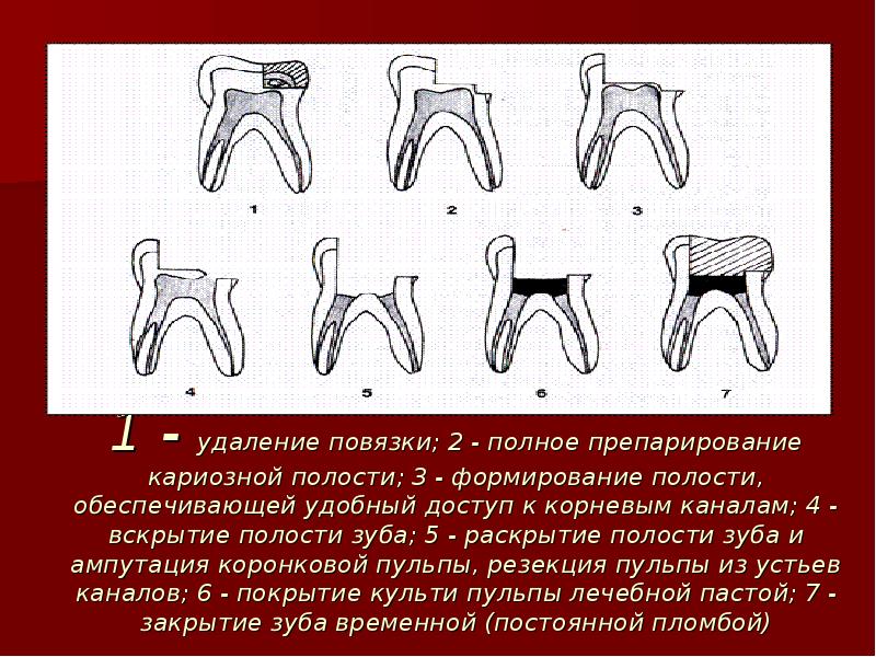 Пульпит карта вызова